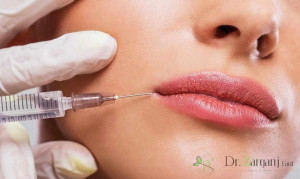 بعد از انجام تزریق ژل مدل قلوه ای باید چه نکاتی را رعایت کرد ؟