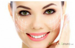 ژل juvederm