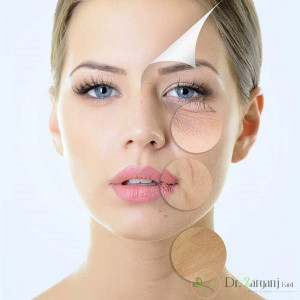 کربوکسی تراپی به چه صورت می باشد؟