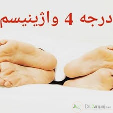 واژینیسموس بر چند نوع می باشد و هر کدام دارای چه ویژگی هایی می باشند؟