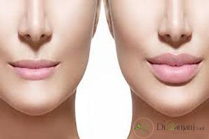 ژل لب پرفکت چگونه محصولی می باشد؟