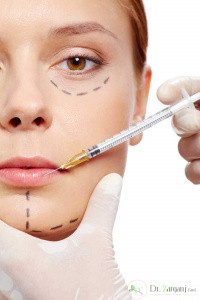 روش تزریق ژل هایومکس بر روی لب ها