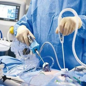 عوارض لاپاراسکوپی چیست؟