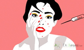 ژل اسکین فیل خوبه؟