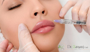 در کدام روش تزریق ژل، بعد از عمل تزریق، نباید خوابید؟