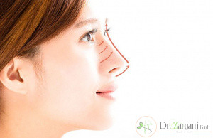 تحت چه شرایطی می توان لیفت بینی با ژل را جایگزین عمل جراحی نمود؟