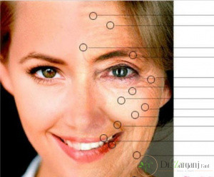 آیا پیش از تزریق مراقبت خاصی لازم است؟