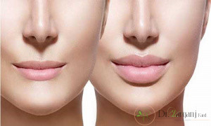 عوارض ژل رووفیل چیست؟