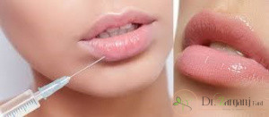 ژل پرفکتا، چگونه ژلی است ؟