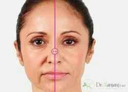 مقدار تزریق ژل گونه