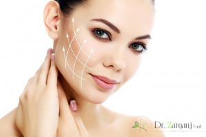 آیا هزینه های زاویه دار کردن بالا می باشد؟