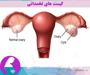 تنظیم چرخه پریودی