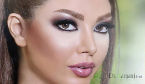 لیفت ابرو چیست ؟