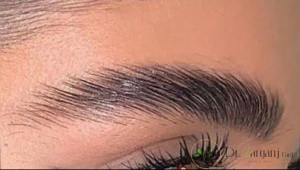 اختلالات حسی و حرکتی در ناحیه پیشانی