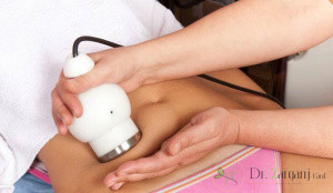 از دستگاه لاغری کویتیشن برای چه نواحی می توان استفاده کرد ؟