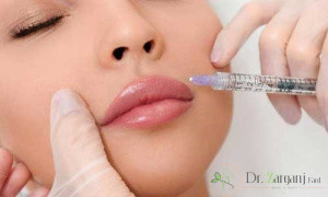 منظور از تزریق ژل ویاکسی