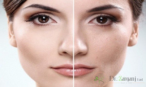 مرکز پاکسازی پوست در شرق تهران چه خدماتی را ارائه می دهد؟