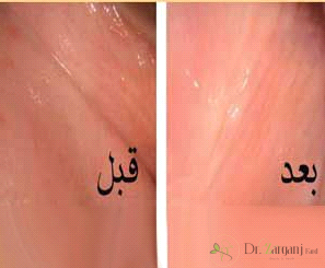 عمل زیبایی ناحیه تناسلی بانوان