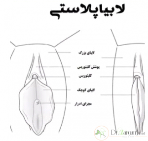 چه زمانی سایز لابیا، بزرگ تر می شود؟