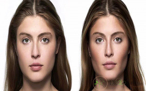 از چه راه هایی میتوان صورت را زاویه دار کرد؟