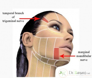 نحوه انجام هایفوتراپی چگونه است؟