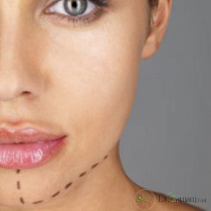 زاویه سازی فک و صورت چه مزایایی دارد؟