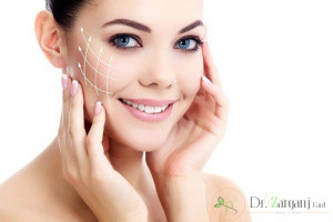مزایای لیفت (زاویهدار کردن) صورت با نخ چیست؟