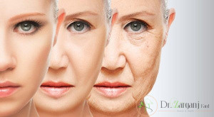لیفتینگ پوست صورت به روش RF Fractional: