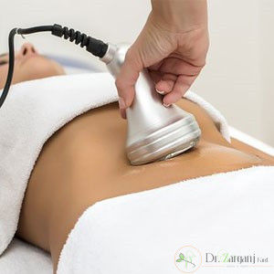 لاغری موضعی به روش لیزر لیپولیز، چگونه است؟