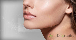 4.چرا برای زاویه دار کردن صورت از ژل استفاده می شود؟