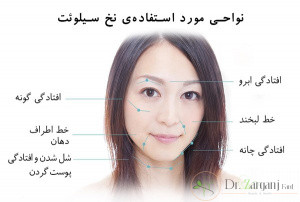 لیفت صورت با نخ چگونه است؟