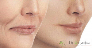 عوارضی که در این عمل ممکن است پیش بیاید چیست؟