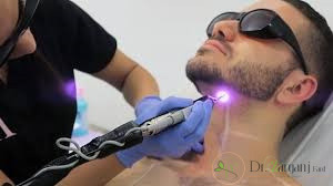تاثیر رنگ و پوست مردان در جواب گرفتن از لیزر چه میزان است؟