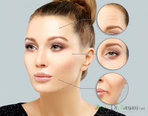 عوارض تزریق بوتاکس دیسپورت کدام موارد است؟