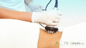 دستگاه لاغری کویتیشن چیست ؟