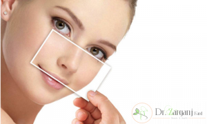 توضیح و مفهوم لیفت بینی؟
