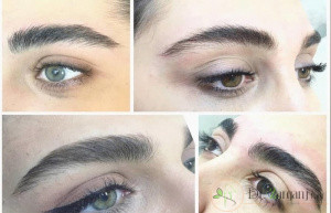 مراقبت های قبل از لیفت ابرو چیست؟