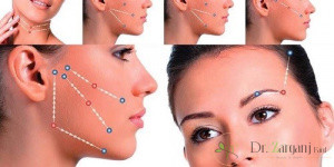تکنیک زاویهدار دادن با نخ برای کدام یک از بخشهای صورت مناسب است؟