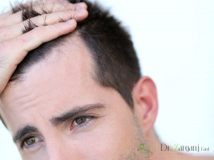 چگونه می توان از لیزر برای از بین بردن مو های زائد پیشانی مردان استفاده کرد ؟