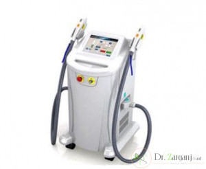 تفاو ت دستگاه موتوس و کندلا از لحاظ ویژگی هایی که دارند چگونه است؟