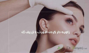 زمان استفاده از ژل ویاکسی
