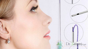 نوع ناهنجاری بینی