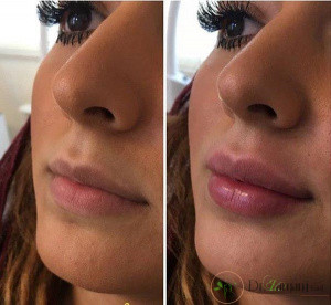 مزیت هایی که استفاده کردن از بهترین مارک های ژل به دنبال دارد؟