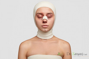 هزینه ی انجام خدمات جراحی های زیبایی چه مقدار می باشد ؟