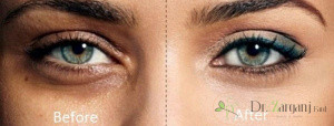 کربوکسی تراپی چه احساسی ایجاد می کند؟