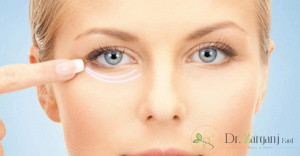 عوارض کربوکسی تراپی دور چشم رابیان کنید: