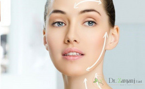 دوام لیفت با نخ چه مدت است؟