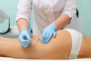 کربوکسی تراپی چه تفاوتی با مزوتراپی دارد؟