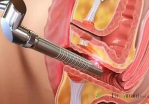 عمل زیبایی واژن چه عوارضی را به دنبال دارد؟ 