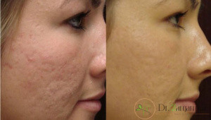 آیا تا به حال درباره ی تاریخچه ی کربوکسی تراپی مطالعه داشته اید؟